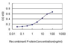 Anti-MTUS1 Mouse Monoclonal Antibody [clone: 1C7]