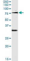 Anti-OXSR1 Antibody Pair