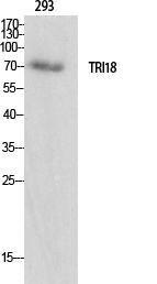 Western blot analysis of various cells using Anti-TRI18 Antibody