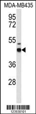 Anti-GABRD Rabbit Polyclonal Antibody