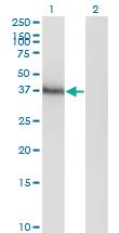 Anti-HOXA11 Mouse Monoclonal Antibody [clone: 8B8]