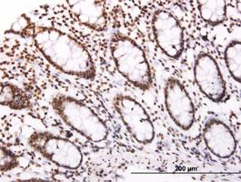 Anti-SOCS3 Mouse Monoclonal Antibody [clone: 1E4]