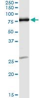 Anti-OXSR1 Antibody Pair