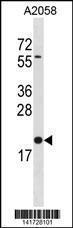 Anti-BLOC1S3 Rabbit Polyclonal Antibody