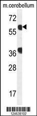 Anti-GTPBP2 Rabbit Polyclonal Antibody (PE (Phycoerythrin))