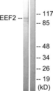 Anti-EEF2 Rabbit Polyclonal Antibody