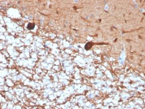 Immunohistochemical analysis of formalin-fixed, paraffin-embedded human cerebellum using Anti-PGP9.5 Antibody [rUCHL1/4557]