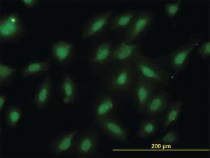 Anti-PSMB6 Mouse Monoclonal Antibody [clone: S51]