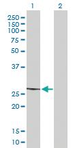 Anti-MRPL22 Mouse Polyclonal Antibody