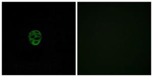 Immunofluorescence analysis of A549 cells using Anti-OR2AE1 Antibody. The right hand panel represents a negative control, where the antibody was pre-incubated with the immunising peptide