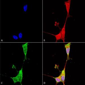 Immunocytochemistry/Immunofluorescence analysis of human neuroblastoma cells (SH-SY5Y), fixed in 4% PFA for 15 min, using Anti-Brevican Antibody [S294A-6] (A304965), at 1:100 for overnight at 4°C with slow rockin