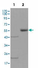 Anti-EPHA5 Mouse Monoclonal Antibody [clone: 8B10B1,8B10F5]