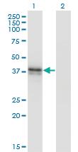 Anti-B3GAT3 Mouse Monoclonal Antibody [clone: 1C11]