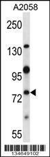 Anti-NEK8 Rabbit Polyclonal Antibody (AP (Alkaline Phosphatase))