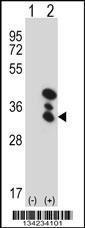 Anti-BLVRA Rabbit Polyclonal Antibody (Biotin)