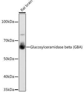 Western blot analysis of extracts of Rat brain, using Anti-GBA Antibody [ARC0500] (A309031) at 1:1,000 dilution