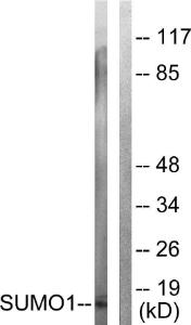 Western blot analysis of lysates from 293 cells using Anti-Sumo1 Antibody. The right hand lane represents a negative control, where the Antibody is blocked by the immunising peptide