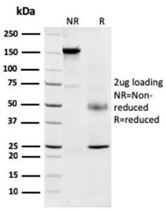 SDS-PAGE analysis of Anti-Nucleophosmin Antibody [NPM1/3287] under non-reduced and reduced conditions; showing intact IgG and intact heavy and light chains, respectively. SDS-PAGE analysis confirms the integrity and purity of the antibody.