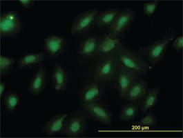 Anti-PSMB6 Mouse Monoclonal Antibody [clone: S51]