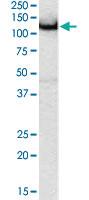 Anti-AMPH Goat Polyclonal Antibody