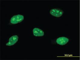 Anti-SOCS3 Mouse Monoclonal Antibody [clone: 1E4]