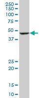 Anti-BLMH Mouse Monoclonal Antibody [clone: 4A2]