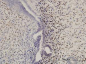 Anti-HOXA11 Mouse Monoclonal Antibody [clone: 8B8]