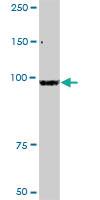 Anti-ZBED1 Rabbit Polyclonal Antibody