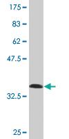 Anti-ISL2 Mouse Monoclonal Antibody [clone: 1D9]