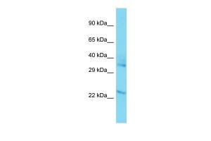 Anti-FAHD2A Rabbit Polyclonal Antibody