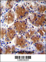 Anti-ABHD17C Rabbit Polyclonal Antibody