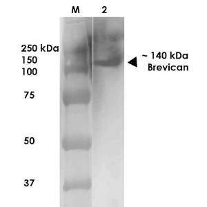 Western blot analysis of rat brain membrane showing detection of ~140 kDa Brevican protein using Anti-Brevican Antibody [S294A-6] (A304965) at 1:1,000 for 1 hour at room temperatur