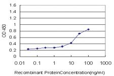 Anti-SOCS3 Mouse Monoclonal Antibody [clone: 1E4]