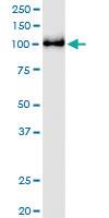 Anti-KDM1A Rabbit Polyclonal Antibody