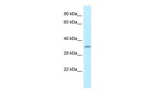 Anti-FAHD2A Rabbit Polyclonal Antibody