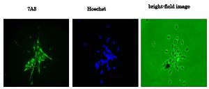 Anti-Nestin Antibod