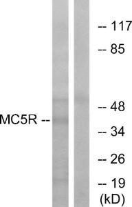 Anti-MC5 Receptor Rabbit Polyclonal Antibody