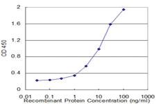 Anti-BLMH Mouse Monoclonal Antibody [clone: 4A2]