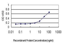 Anti-PSMB6 Mouse Monoclonal Antibody [clone: S51]