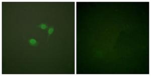 Immunofluorescence analysis of NIH/3T3 cells using Anti-Sumo1 Antibody. The right hand panel represents a negative control, where the Antibody was pre-incubated with the immunising peptide