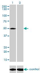 Anti-ACP2 Mouse Monoclonal Antibody [clone: M1-4A12]