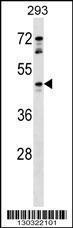 Anti-HCAR1 Rabbit Polyclonal Antibody (APC (Allophycocyanin))