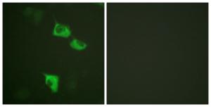 Anti-EEF2 Rabbit Polyclonal Antibody