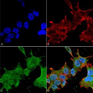 Immunocytochemistry/Immunofluorescence analysis of human neuroblastoma cell line (SK-N-BE, fixed in 4% formaldehyde for 15 min at room temperature, using Anti-Brevican Antibody [S294A-6] (A304965), at 1:100 for 60 minutes at room temperatur