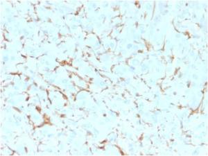 Immunohistochemical analysis of formalin-fixed, paraffin-embedded human adrenal gland using Anti-p75 NGF Receptor Antibody [NGFR5]