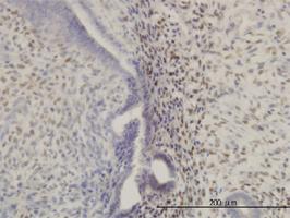 Anti-HOXA11 Mouse Monoclonal Antibody [clone: 8B8]