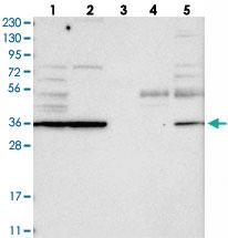 Anti-TPST2 Rabbit Polyclonal Antibody