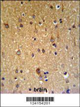 Anti-ZDHHC9 Rabbit Polyclonal Antibody (Biotin)