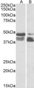 Anti-PLIN3 Antibody (A83081) (0.03 µg/ml) staining of HeLa (lane 1) and Human Colon cancer (lane two) lysate (35 µg protein in RIPA buffer). Primary incubation was 1 hour. Detected by chemilu minescence