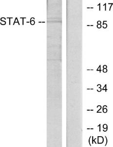 Anti-STAT6 Rabbit Polyclonal Antibody